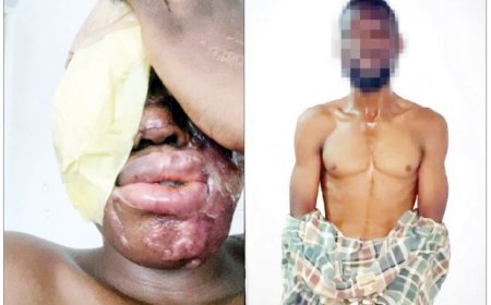 'I Was Paid ₦500,000 to Throw Acid' — Suspect Admits Mistaking Target in Lagos Spa Attack