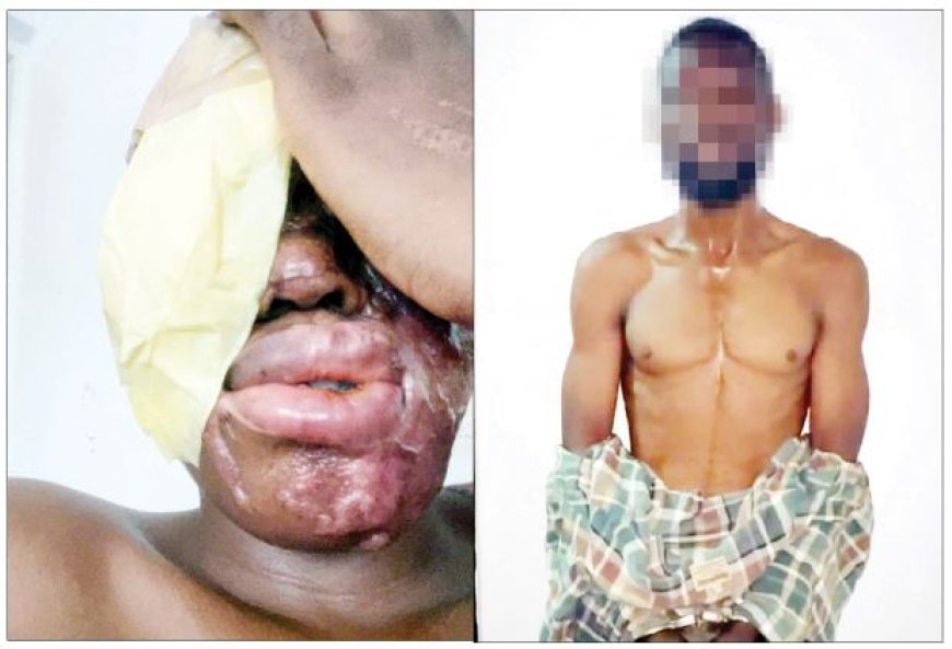 'I Was Paid ₦500,000 to Throw Acid' — Suspect Admits Mistaking Target in Lagos Spa Attack
