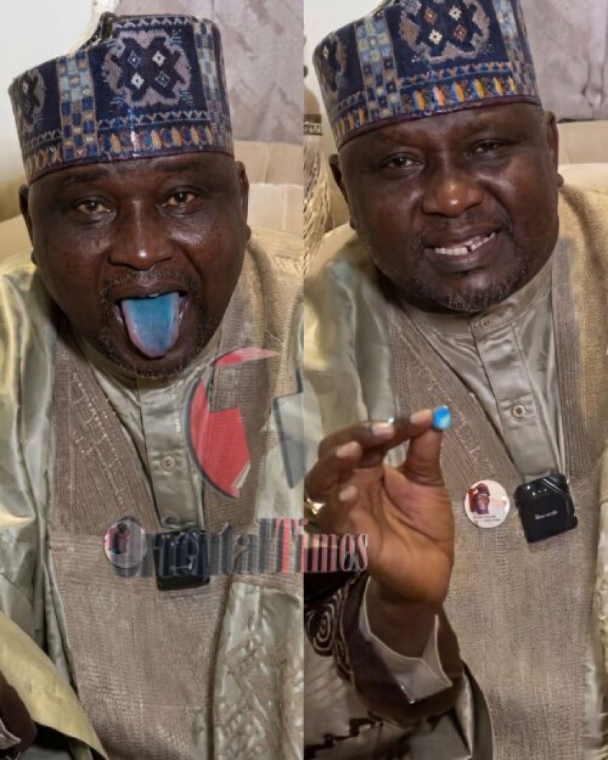 I Don't Do Drugs, "Blue Candy" Caused my Blue Tongue - Lawmaker Cries Out